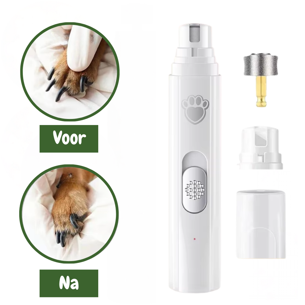 SilentTrim Nagelgrinder – Fluisterstil & effectief trimmen